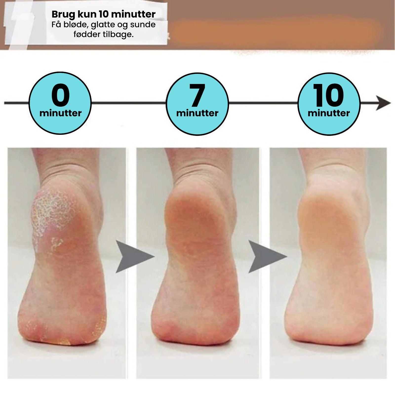 Smooth Feet - Dissolvant électrique pour peaux dures